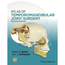 Atlas of Temporomandibular Joint Surgery