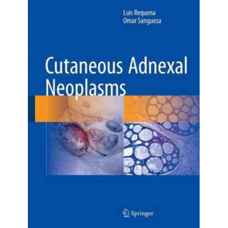 Cutaneous Adnexal Neoplasms