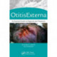 Otitis Externa: An Essential Guide to Diagnosis and Treatment