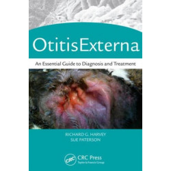 Otitis Externa: An Essential Guide to Diagnosis and Treatment