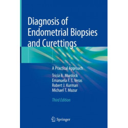 Diagnosis of Endometrial Biopsies and Curettings: A Practical Approach