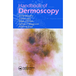 Handbook of Dermoscopy