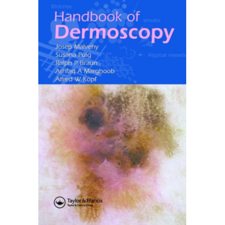 Handbook of Dermoscopy