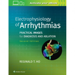 Electrophysiology of Arrhythmias: Practical Images for Diagnosis and Ablation