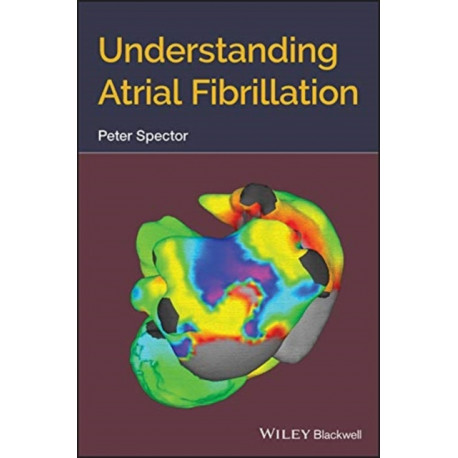 Understanding Atrial Fibrillation