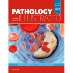 Pathology Illustrated