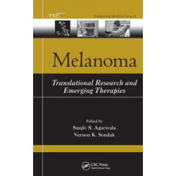 Melanoma: Translational Research and Emerging Therapies