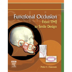 Functional Occlusion: From TMJ to Smile Design