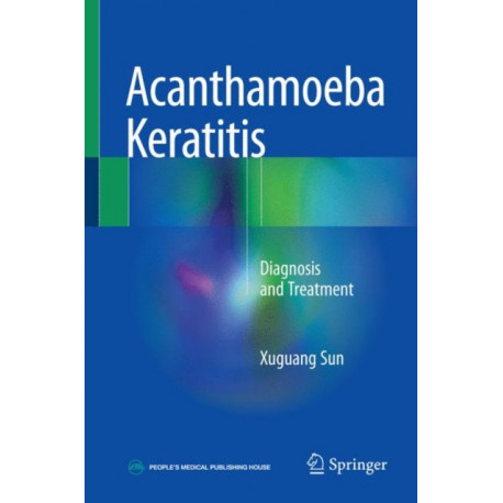 Acanthamoeba Keratitis: Diagnosis and Treatment