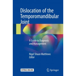 Dislocation of the Temporomandibular Joint: A Guide to Diagnosis and Management