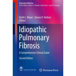 Idiopathic Pulmonary Fibrosis: A Comprehensive Clinical Guide