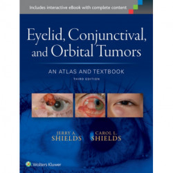 Eyelid, Conjunctival, and Orbital Tumors: An Atlas and Textbook