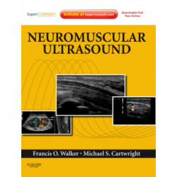 Neuromuscular Ultrasound: Expert Consult - Online and Print