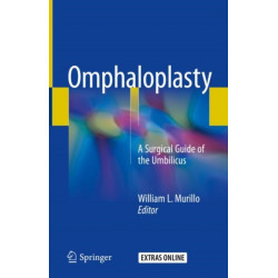 Omphaloplasty: A Surgical Guide of the Umbilicus