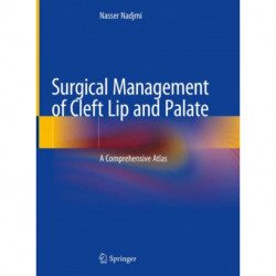 Surgical Management of Cleft Lip and Palate: A Comprehensive Atlas