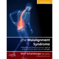 The Malalignment Syndrome: diagnosis and treatment of common pelvic and back pain