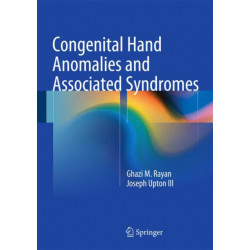 Congenital Hand Anomalies and Associated Syndromes