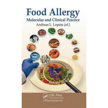 Food Allergy: Molecular and Clinical Practice