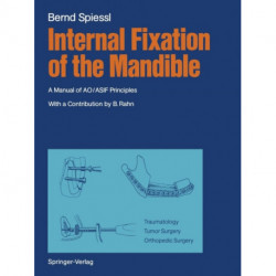 Internal Fixation of the Mandible: A Manual of AO/ASIF Principles