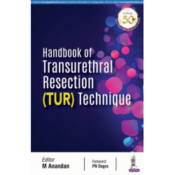 Handbook of Transurethral Resection Techniques
