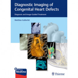 Diagnostic Imaging of Congenital Heart Defects: Diagnosis and Image-Guided Treatment