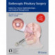 Endoscopic Pituitary Surgery: Endocrine, Neuro-Ophthalmologic, and Surgical Management