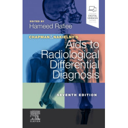 Chapman & Nakielny's Aids to Radiological Differential Diagnosis: Expert Consult - Online and Print