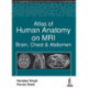 Atlas of Human Anatomy on MRI: Brain, Chest & Abdomen