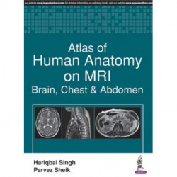 Atlas of Human Anatomy on MRI: Brain, Chest & Abdomen