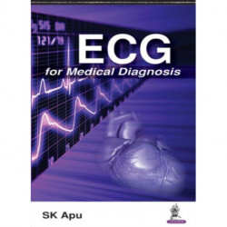 ECG for Medical Diagnosis