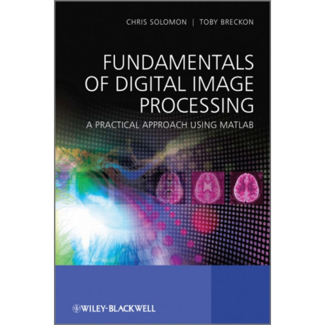 Fundamentals of Digital Image Processing: A Practical Approach with Examples in Matlab