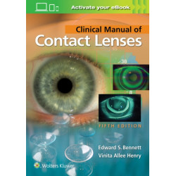Clinical Manual of Contact Lenses