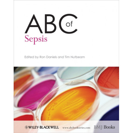 ABC of Sepsis