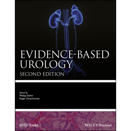 Evidence-based Urology