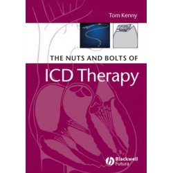 The Nuts and Bolts of ICD Therapy