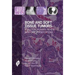 Bone and Soft Tissue Tumors: A Multidisciplinary Review with Case Presentations