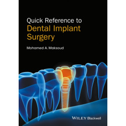 Quick Reference to Dental Implant Surgery