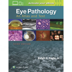 Eye Pathology: An Atlas and Text