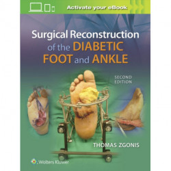 Surgical Reconstruction of the Diabetic Foot and Ankle