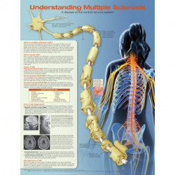 Understanding Multiple Sclerosis Anatomical Chart