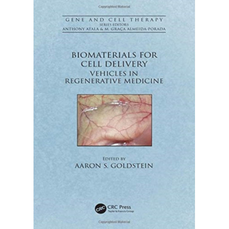Biomaterials for Cell Delivery: Vehicles in Regenerative Medicine