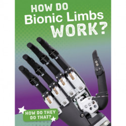 How Do Bionic Limbs Work?
