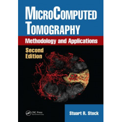 MicroComputed Tomography: Methodology and Applications, Second Edition