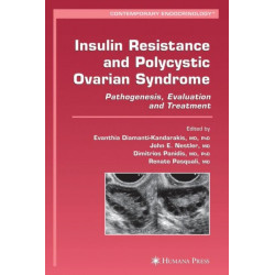 Insulin Resistance and Polycystic Ovarian Syndrome: Pathogenesis, Evaluation, and Treatment