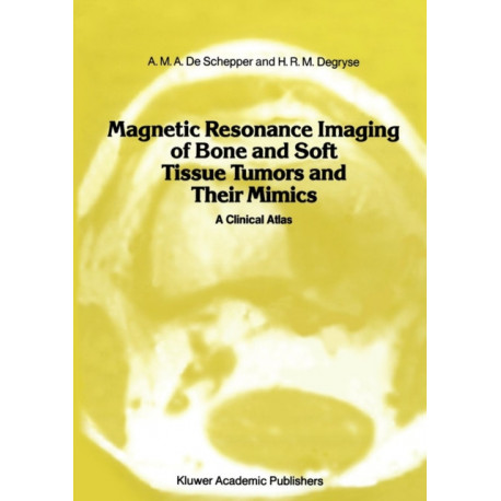 Magnetic Resonance Imaging of Bone and Soft Tissue Tumors and Their Mimics: A Clinical Atlas