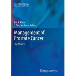 Management of Prostate Cancer
