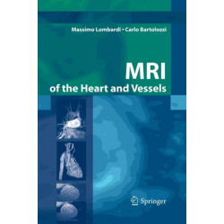 MRI of the Heart and Vessels