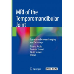 MRI of the Temporomandibular Joint: Correlation Between Imaging and Pathology