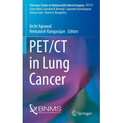 PET/CT in Lung Cancer