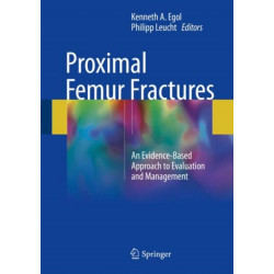 Proximal Femur Fractures: An Evidence-Based Approach to Evaluation and Management